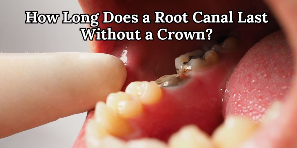 How Long Does a Root Canal Last Without a Crown